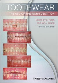 Produktbild: Toothwear