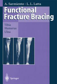Produktbild: Functional Fracture Bracing
