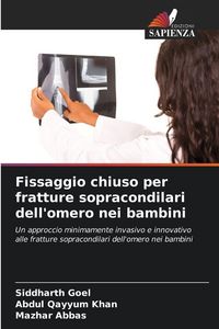 Produktbild: Fissaggio chiuso per fratture sopracondilari dell'omero nei bambini