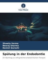 Produktbild: Sp&uuml;lung in der Endodontie