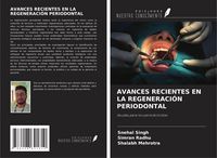 Produktbild: Avances Recientes En La Regeneraci&oacute;n Periodontal