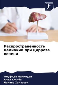 Produktbild: Rasprostranennost' celiakii pri cirroze pecheni