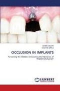 Produktbild: Occlusion in Implants