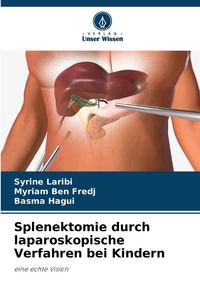 Produktbild: Splenektomie durch laparoskopische Verfahren bei Kindern