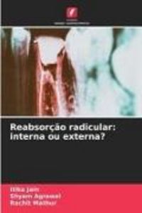 Produktbild: Reabsor&ccedil;&atilde;o radicular: interna ou externa?