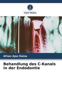 Produktbild: Behandlung des C-Kanals in der Endodontie