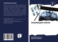 Produktbild: Rezorbciya Kornya
