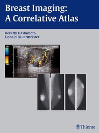 Produktbild: Breast Imaging
