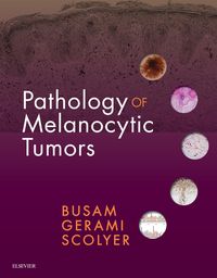 Produktbild: Pathology of Melanocytic Tumors E-Book