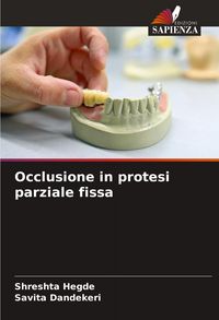 Produktbild: Occlusione in protesi parziale fissa