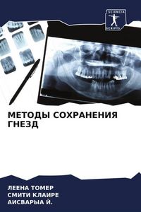 Produktbild: METODY SOHRANENIYa GNEZD