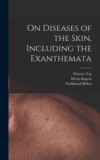 Produktbild: On Diseases of the Skin, Including the Exanthemata