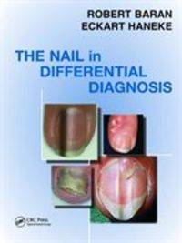 Produktbild: Nail in Differential Diagnosis