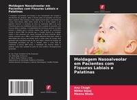 Produktbild: Moldagem Nasoalveolar em Pacientes com Fissuras Labiais e Palatinas
