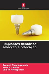 Produktbild: Implantes dent&aacute;rios: selec&ccedil;&atilde;o e coloca&ccedil;&atilde;o