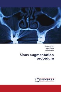 Produktbild: Sinus augmentation procedure