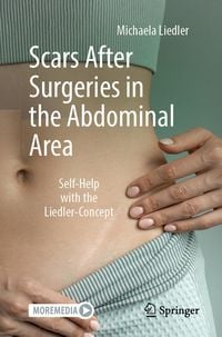 Produktbild: Scars After Surgeries in the Abdominal Area