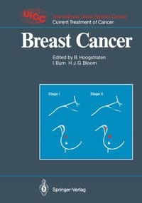 Produktbild: Breast Cancer