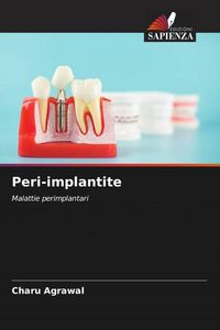 Produktbild: Peri-implantite