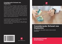 Produktbild: Considera&ccedil;&atilde;o Oclusal nos Implantes