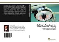 Produktbild: Software Assistance in Liver Resection Surgery