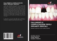 Produktbild: Fallimenti E Complicazioni Degli Impianti Dentali