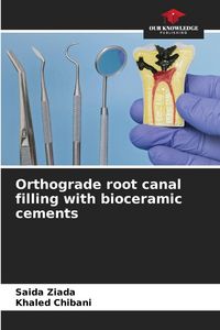 Produktbild: Orthograde root canal filling with bioceramic cements