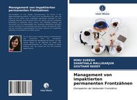 Produktbild: Management von impaktierten permanenten Frontz&auml;hnen