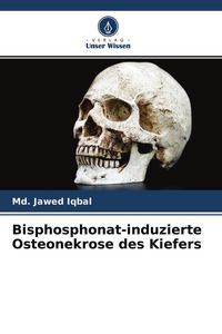 Produktbild: Bisphosphonat-induzierte Osteonekrose des Kiefers