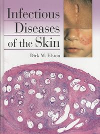 Produktbild: Infectious Diseases Of The Ski