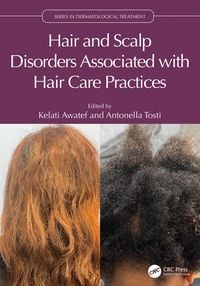 Produktbild: Hair and Scalp Disorders Associated with Hair Care Practices
