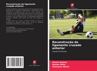 Produktbild: Reconstru&ccedil;&atilde;o do ligamento cruzado anterior