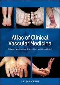 Produktbild: Atlas of Clinical Vascular Medicine