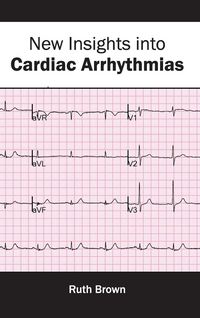 Produktbild: New Insights into Cardiac Arrhythmias