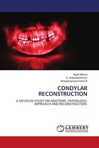 Produktbild: Condylar Reconstruction