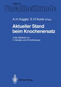 Produktbild: Aktueller Stand beim Knochenersatz