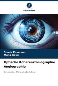 Produktbild: Optische Koh&auml;renztomographie Angiographie