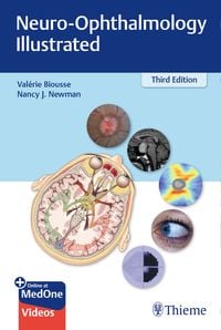 Produktbild: Neuro-Ophthalmology Illustrated