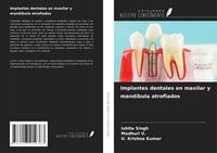 Produktbild: Implantes dentales en maxilar y mand&iacute;bula atrofiados