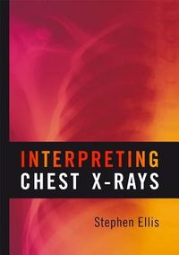 Produktbild: Interpreting Chest X-Rays
