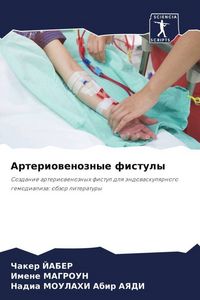 Produktbild: Arteriowenoznye fistuly