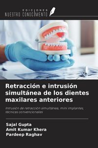 Produktbild: Retracci&oacute;n e intrusi&oacute;n simult&aacute;nea de los dientes maxilares anteriores