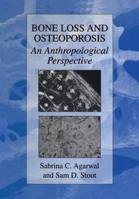 Produktbild: Bone Loss and Osteoporosis