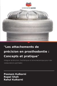 Produktbild: "Les attachements de pr&eacute;cision en prosthodontie : Concepts et pratique"