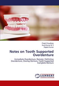 Produktbild: Notes on Tooth Supported Overdenture