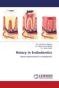 Produktbild: Rotary in Endodontics