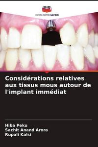 Produktbild: Consid&eacute;rations relatives aux tissus mous autour de l'implant imm&eacute;diat