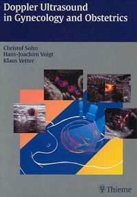 Produktbild: Doppler Ultrasound in Gynecolo