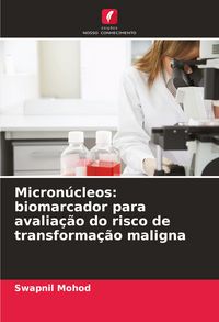 Produktbild: Micron&uacute;cleos: biomarcador para avalia&ccedil;&atilde;o do risco de transforma&ccedil;&atilde;o maligna