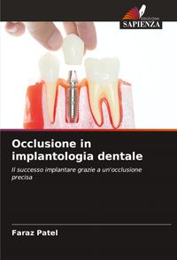 Produktbild: Occlusione in implantologia dentale